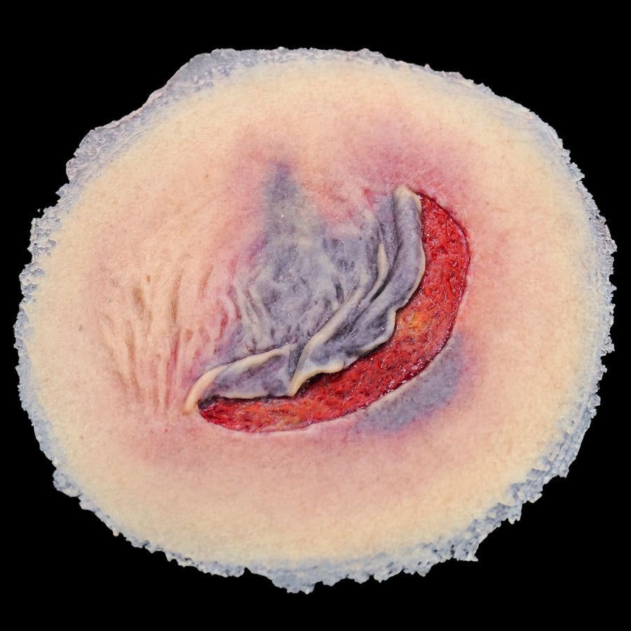 degloving-injury-moulage-techline-technologies.jpg Degloving Injury Moulage CS010 - Image 1