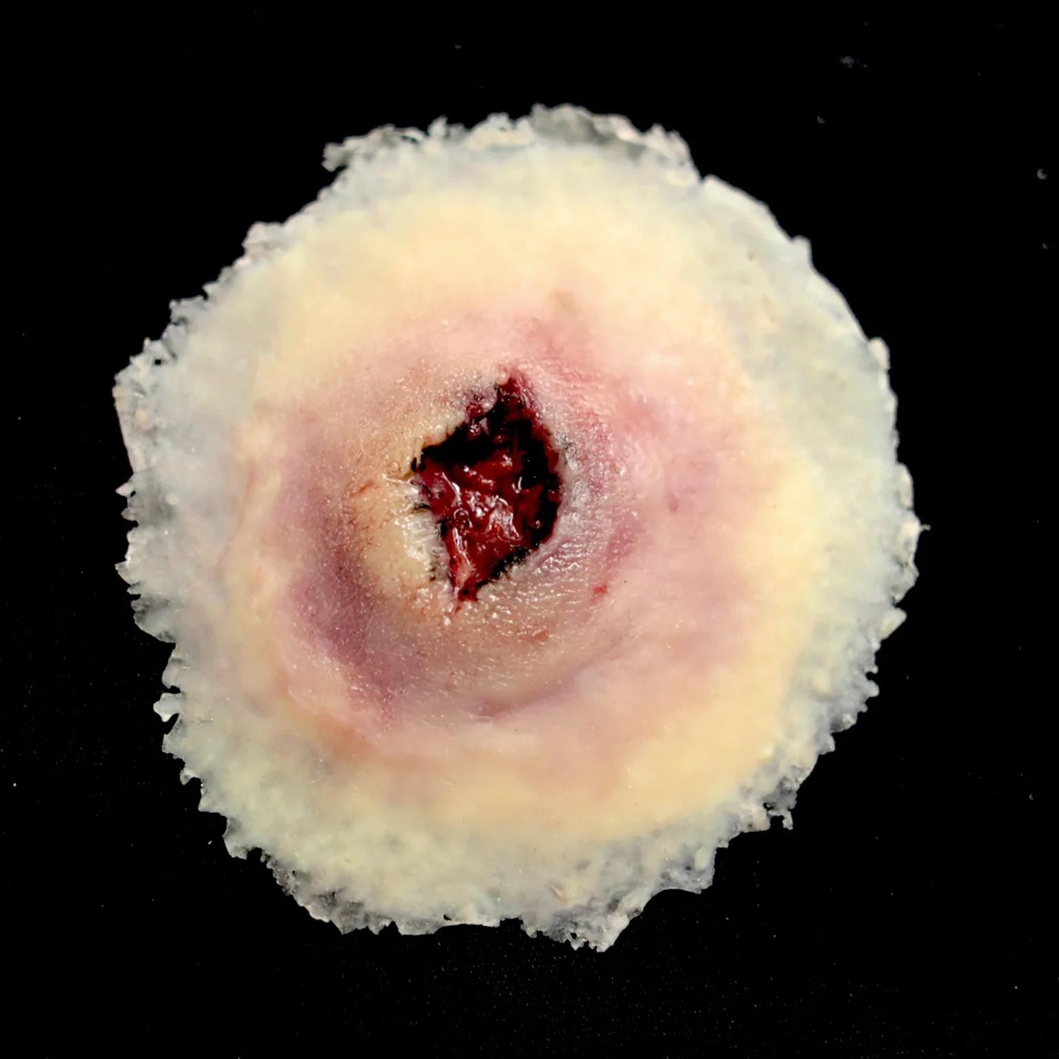 large-entry-gunshot-wound-simulation.jpg Gunshot Entry Wound, Large - Image 1