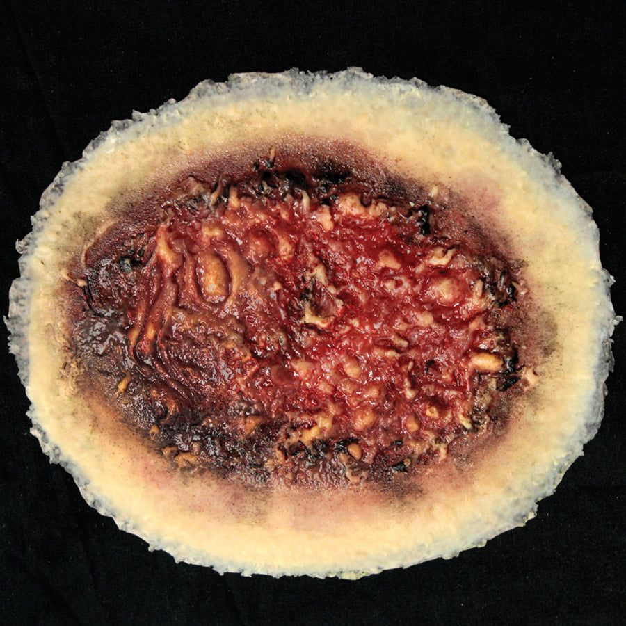large-thermal-burn-simulation.jpg Thermal Burn, Large - Image 1