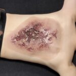 Torso Burn, Large