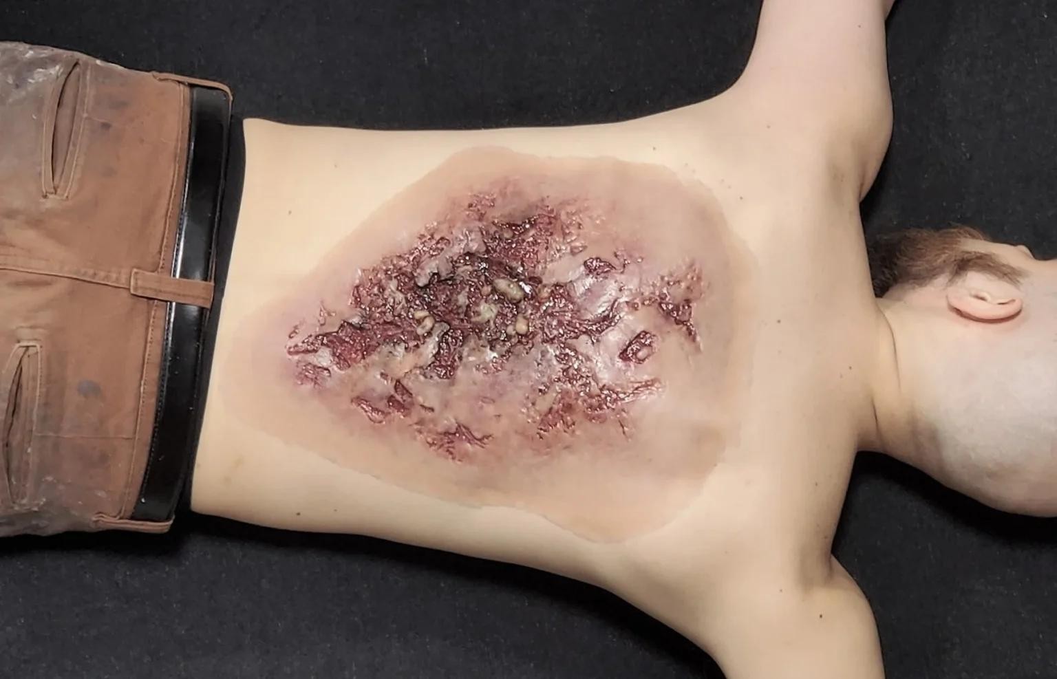 techline-technologies-large-torso-burn-simulation.jpg Torso Burn, Large - Image 1