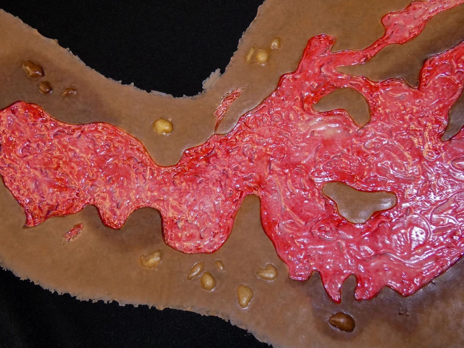 third-degree-chest-burn-simulation-debrided.jpg Third-Degree Chest Burn (Debrided) - Image 1